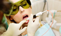 Лазерная стоматология в Москве